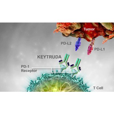 Keytruda is effective for cervical cancer